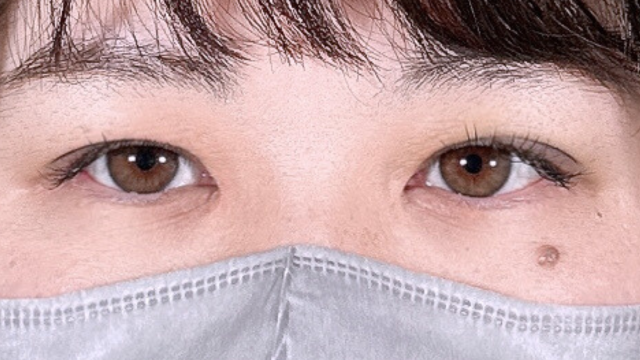 Postoperative Condition Part 1