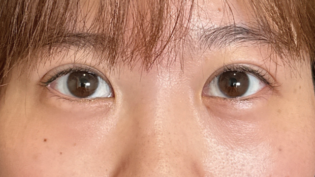 Postoperative Condition Part 1