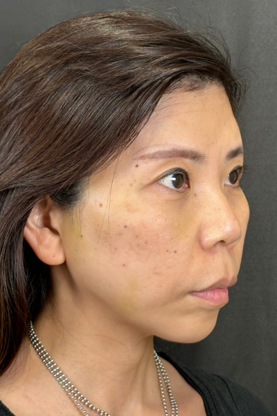 Postoperative Condition Part 1