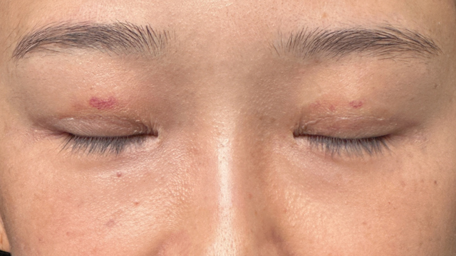 Postoperative Condition Part 1