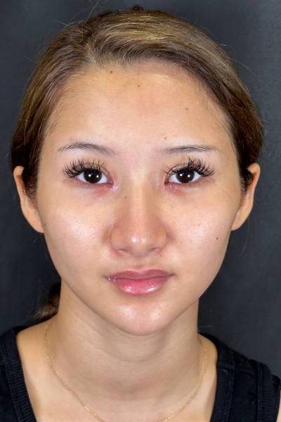 Postoperative Condition Part 1