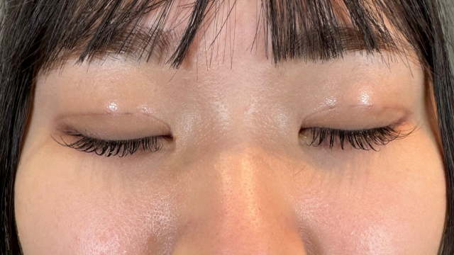 Postoperative Condition Part 1