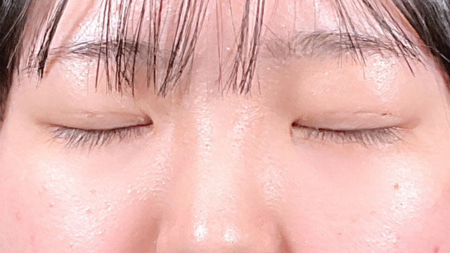 Postoperative Condition Part 1