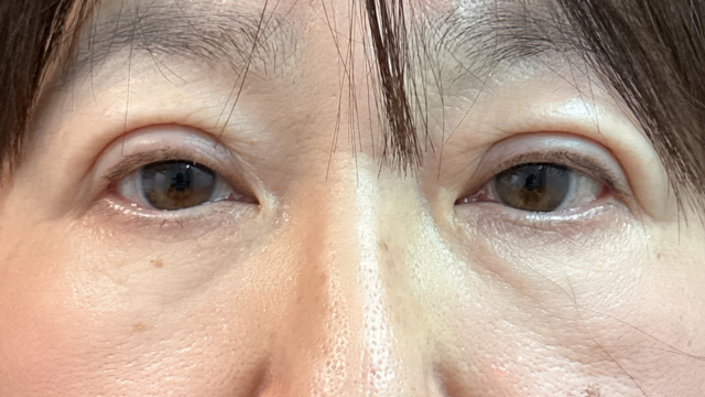 Postoperative Condition Part 1