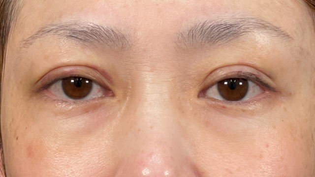 Postoperative Condition Part 1