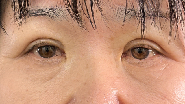 Postoperative Condition Part 1