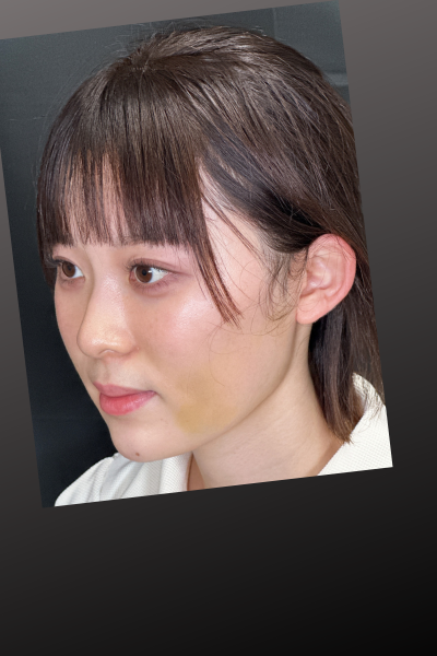 Postoperative Condition Part 1