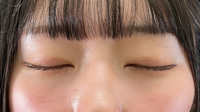 Postoperative Condition Part 1