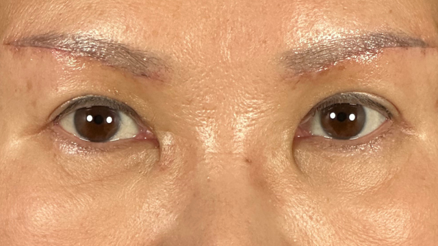 Postoperative Condition Part 1