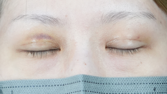 Postoperative Condition Part 1