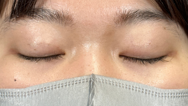 Postoperative Condition Part 1