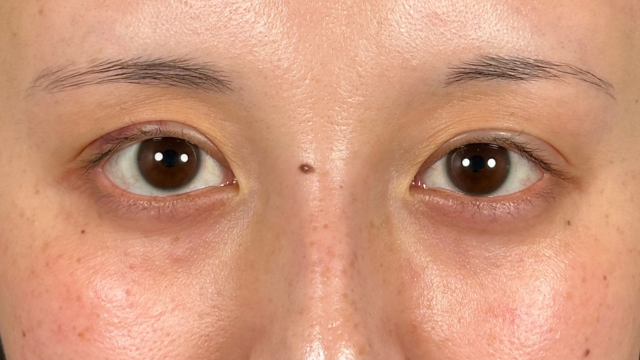 Postoperative Condition Part 1