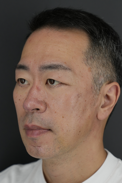 Postoperative Condition Part 1