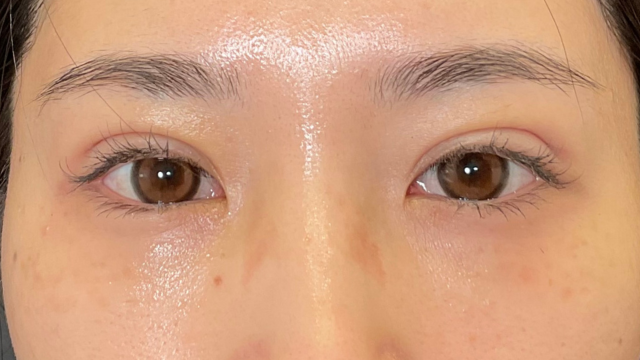 Postoperative Condition Part 1