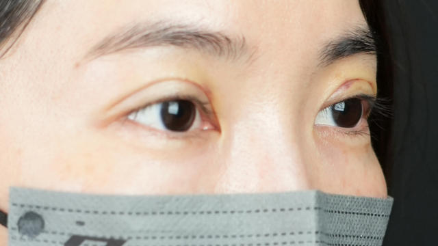 Postoperative Condition Part 1