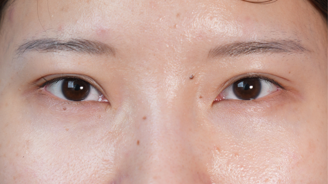 Postoperative Condition Part 1