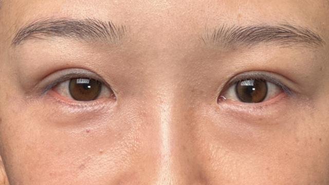 Postoperative Condition Part 1