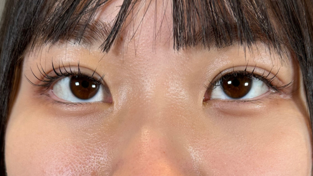 Postoperative Condition Part 1