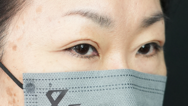 Postoperative Condition Part 1