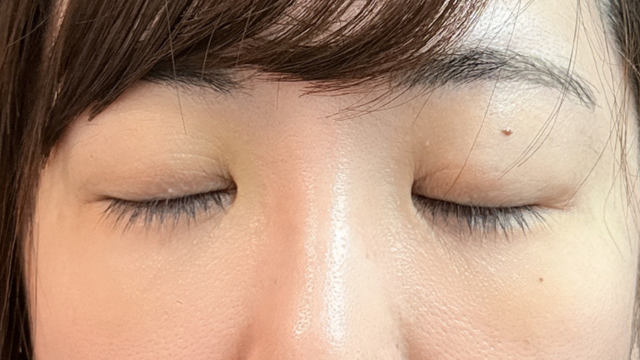 Postoperative Condition Part 1