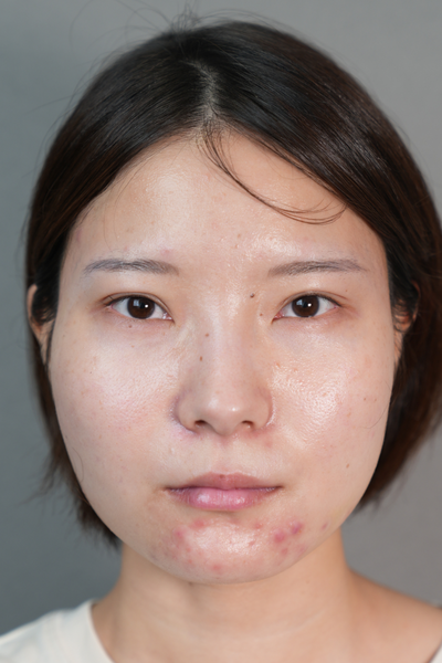 Postoperative Condition Part 1