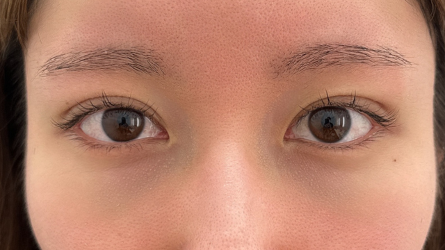 Postoperative Condition Part 1