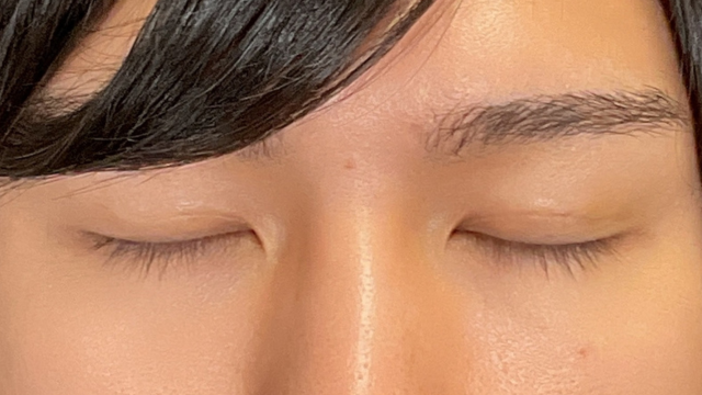 Postoperative Condition Part 1