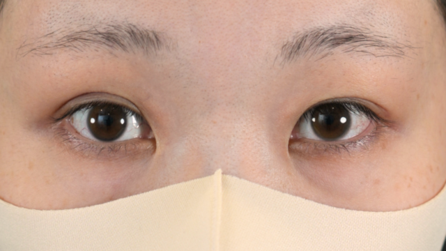 Postoperative Condition Part 1