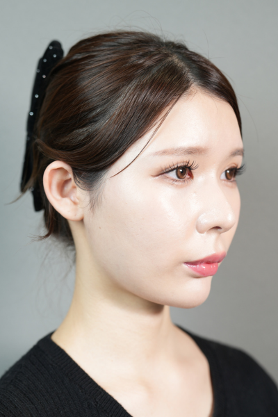 Postoperative Condition Part 1