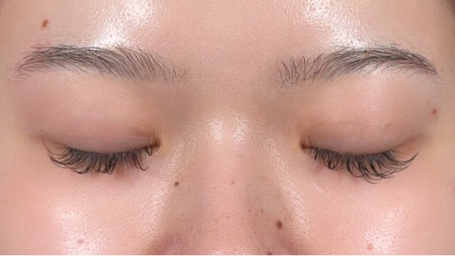 Postoperative Condition Part 1