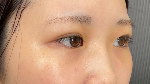 Postoperative Condition Part 1