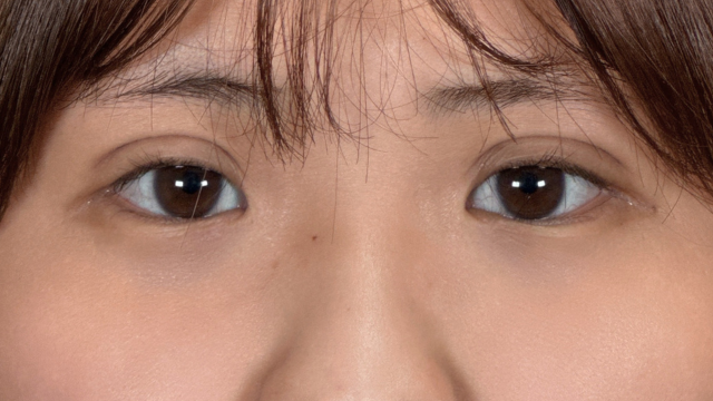 Postoperative Condition Part 1