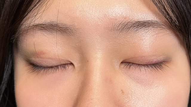 Postoperative Condition Part 1