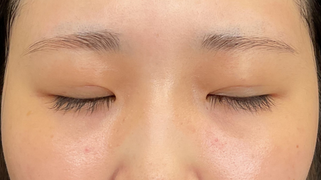 Postoperative Condition Part 1