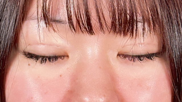 Postoperative Condition Part 1