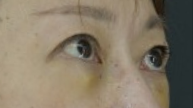 Postoperative Condition Part 1