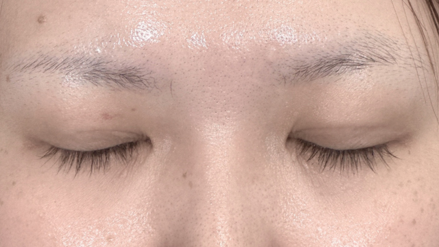 Postoperative Condition Part 1