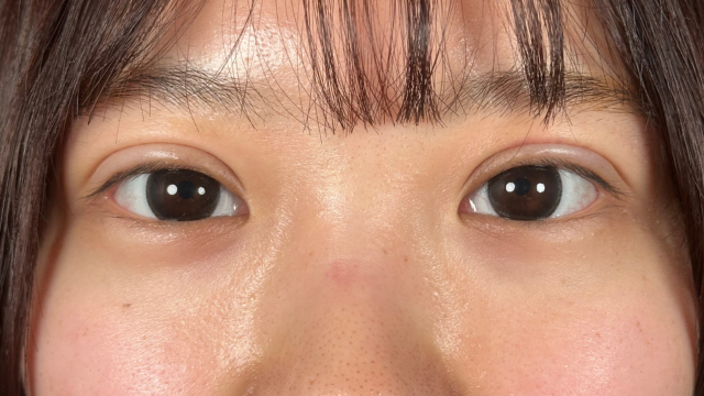 Postoperative Condition Part 1