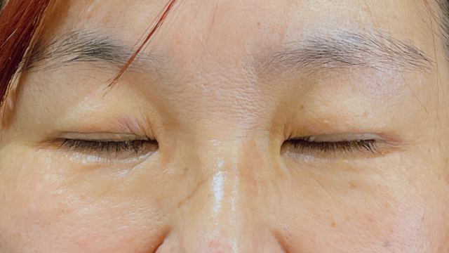 Postoperative Condition Part 1