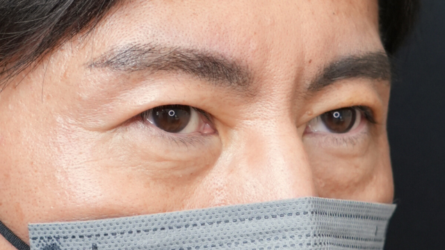 Postoperative Condition Part 1