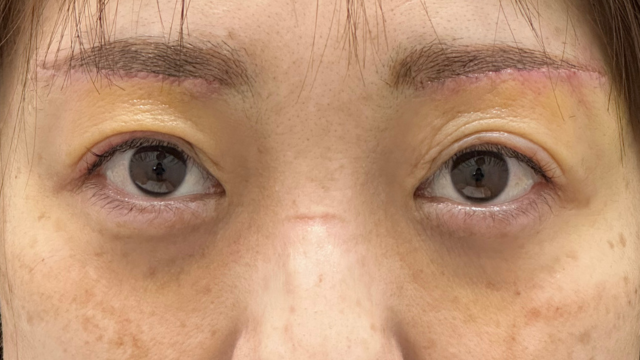 Postoperative Condition Part 1