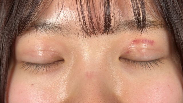 Postoperative Condition Part 1