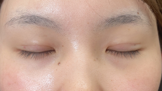 Postoperative Condition Part 1