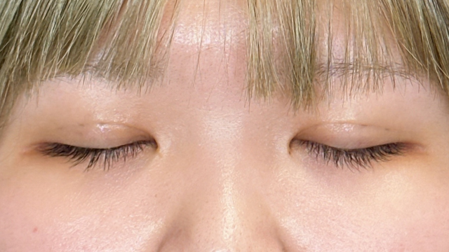 Postoperative Condition Part 1