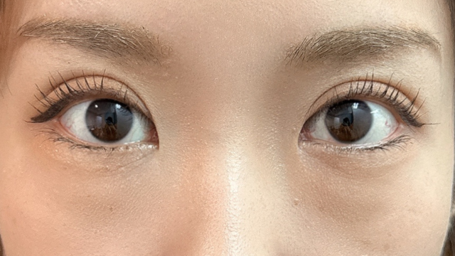 Postoperative Condition Part 1