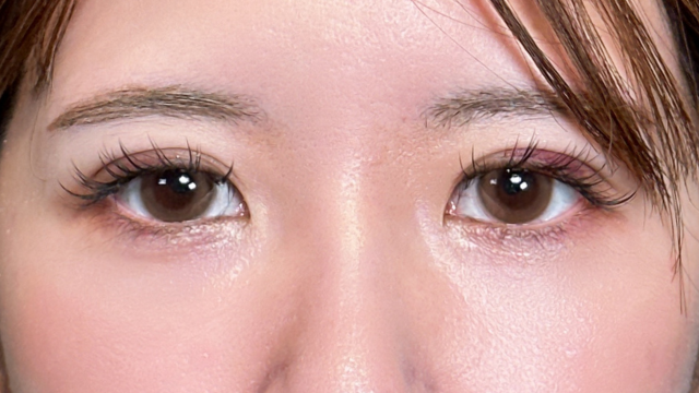 Postoperative Condition Part 1