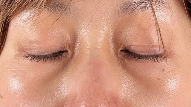 Postoperative Condition Part 1