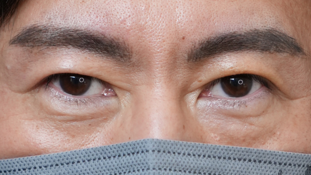 Postoperative Condition Part 1