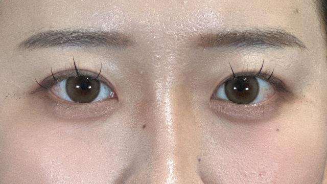 Postoperative Condition Part 1