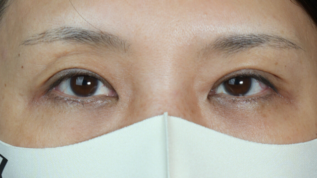 Postoperative Condition Part 1